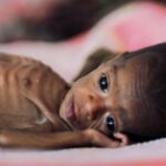 मुरबाडमधील बालकांना कुपोषणाचा फास, 344 चिमुकल्यांची प्रकृती गंभीर