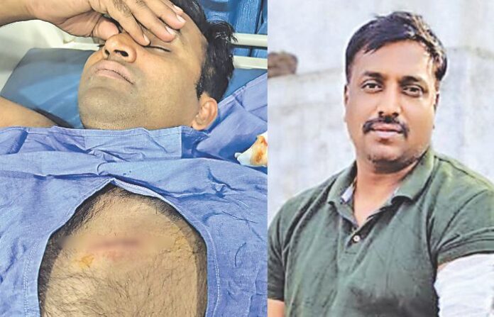 Dacoit attacks Pimpri Chinchwad cops