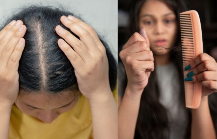 Hair Fall