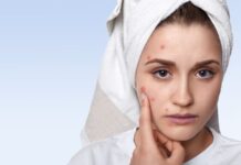 थंडीच्या कडाक्यात वाढले त्वचा विकार