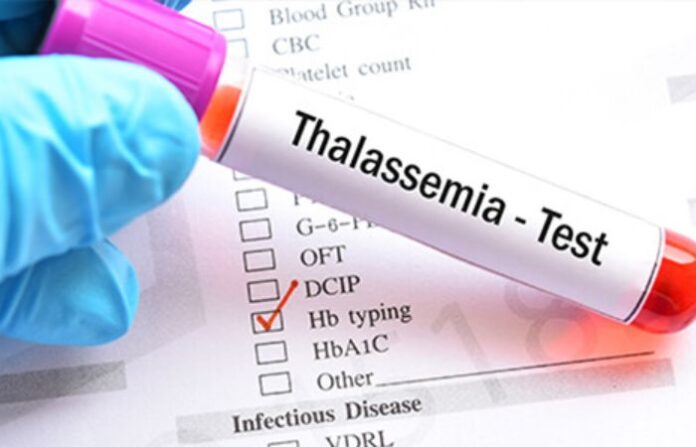 thalassemia