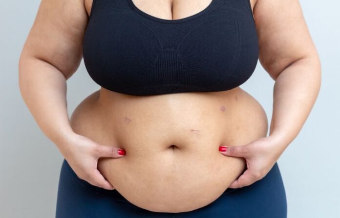 Belly Fat (1)
