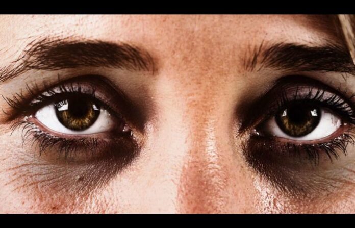 Black eyes (3)