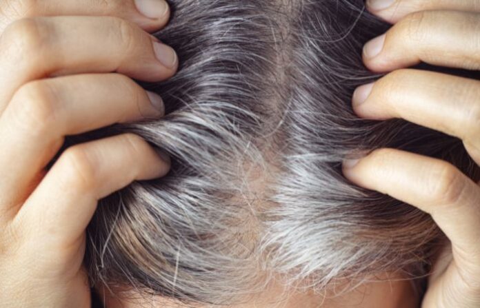 Gray Hair (1)