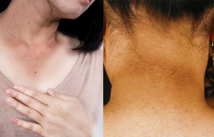 Neck (2)