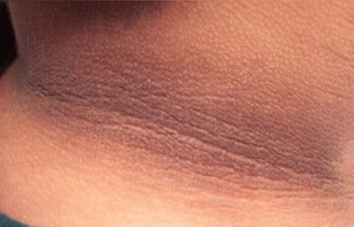 Neck (6)