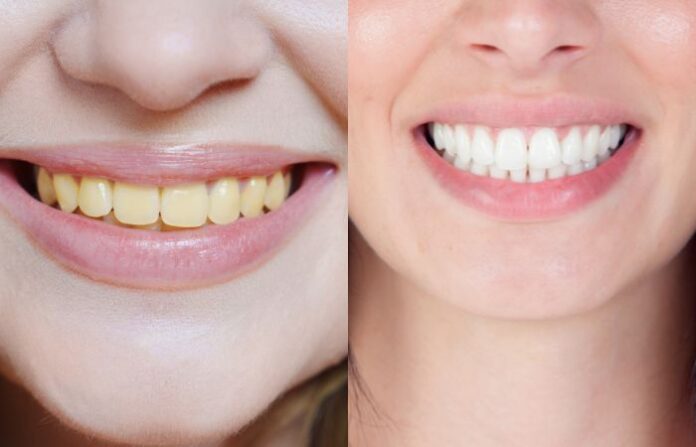 Teeth