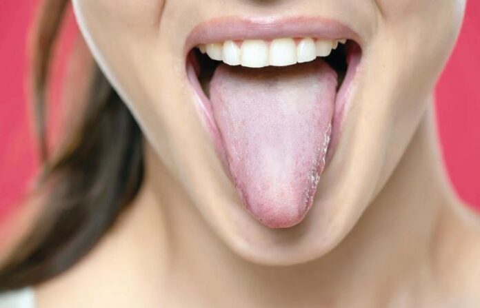 _tounge