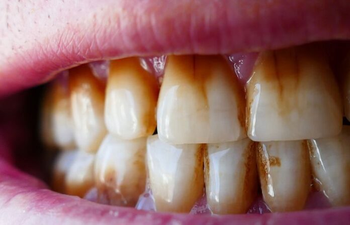 teeth 5