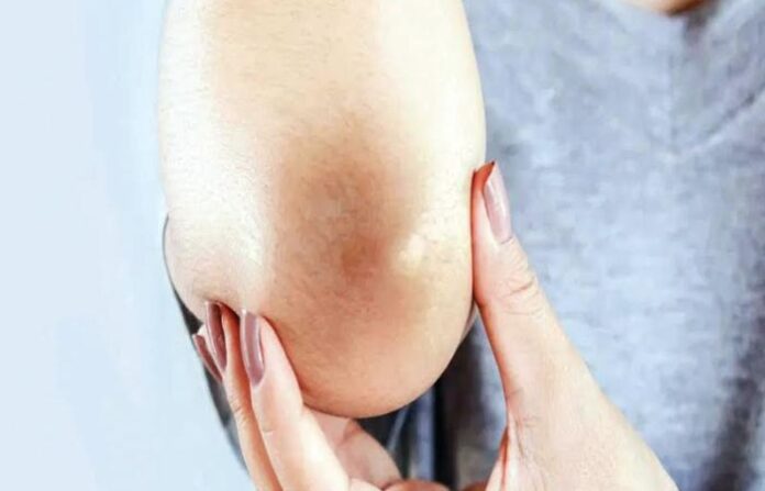 elbows