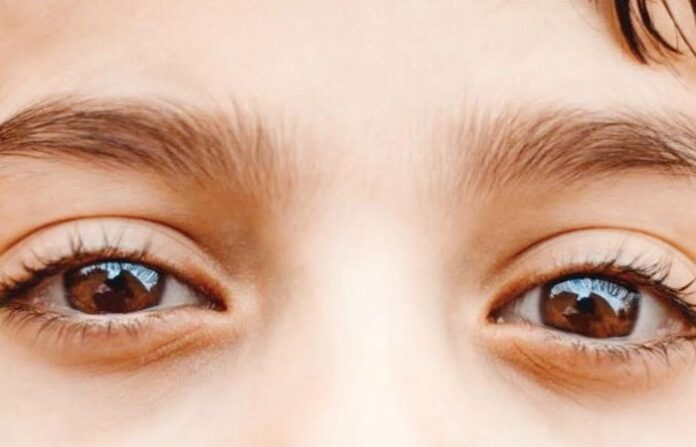 eyes