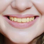 पिवळ्या दातांवर ‘हा’ आहे जालीम उपाय, वाचा