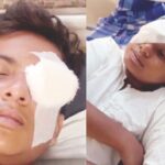 ‘कार्बाइड गन’मुळे 14 मुलांनी गमावली दृष्टी, दी असूनही मध्य प्रदेशात राजरोस विक्री