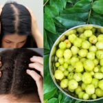 हिवाळ्यात केसातील कोंडा कमी करण्यासाठी हे नैसर्गिक डिटॉक्स पेय दररोज प्यायलाच हवे