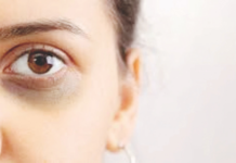 डोळ्याखाली काळी वर्तुळे असतील तर, हे करून पहा