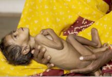 सामना अग्रलेख – बालमृत्यूंचे लांच्छन!