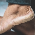 हिवाळ्यात तुमच्याही पायांना भेगा पडल्यात का, करुन बघा हे उपाय