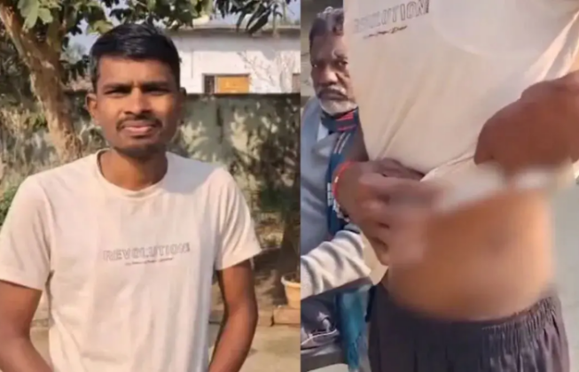 chandrapur kidney racket