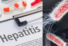 केरळमध्ये Hepatitis A चा कहर, 31 हजारांहून अधिक रुग्ण आढळले