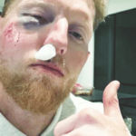 ben stokes facial injury england test captain hit by ball during practice session