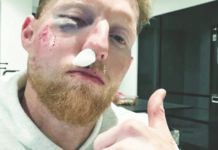 ben stokes facial injury england test captain hit by ball during practice session