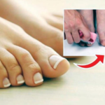 पायांच्या नखांमध्ये मळ साचला… हे करून पहा