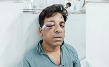 तोंडावर भयंकर ठोशे लगावले, डोळा जायबंदी; परप्रांतीय बाप-बेट्याचा मराठी तरुणावर जीवघेणा हल्ला, ठाणे रेल्वे स्थानकातील घटना