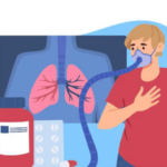 प्रासंगिक – क्षयरोग निर्मूलन: लोकसहभागाला महत्त्व tuberculosis eradication importance of public participation