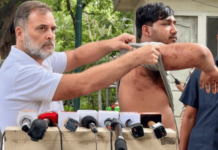 धर्मेंद्र प्रधान गुन्हेगार शिक्षणमंत्री, आंदोलक तरुणावर पॅलेट गनने हल्ला झाल्या प्रकरणी राहुल गांधी यांचा घणाघात