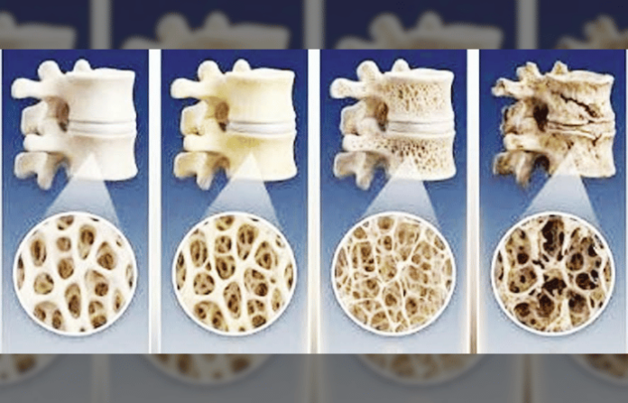 bone