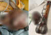 दिल्ली विमानतळावर प्रवाशाच्या हँड बॅगमध्ये आढळली मानवी कवटी; सीआयएसएफची कारवाई