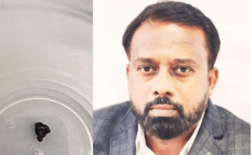 33 वर्षांपूर्वीच्या बॉम्बस्फोटातील तुकडा शरीरात; एम आर आय दरम्यान लागला शोध, हिंदुजा रुग्णालयात उपचार दरम्यान प्रकार उघडकीस