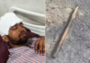 मेट्रोची लोखंडी सळई दुचाकीस्वाराच्या डोक्यात