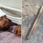 मेट्रोची लोखंडी सळई दुचाकीस्वाराच्या डोक्यात